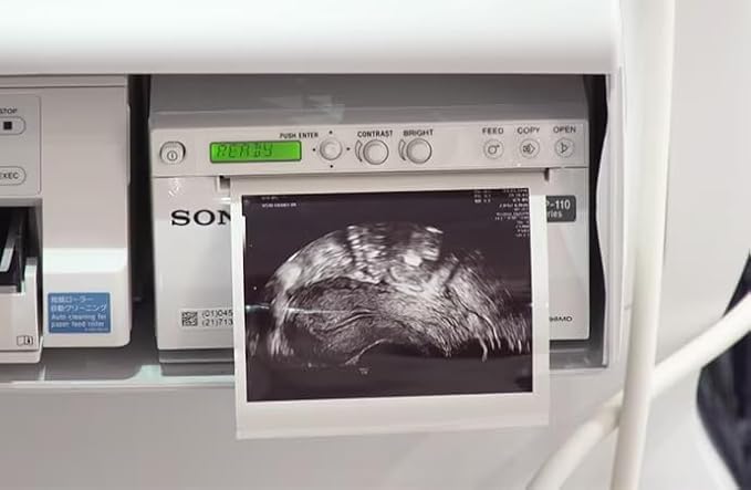 Chimloon UPP110HG High Gloss Video Ultrasound Printer Paper Type V Black and White Thermal Film Compatible for Sony UPP-110HG 110mm x 18m (10 Rolls)